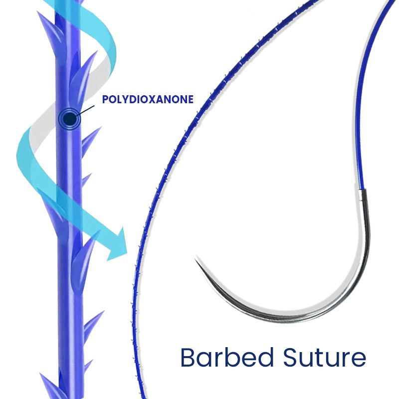 medical consumables absorbable sterile barbed surgical suture with loop