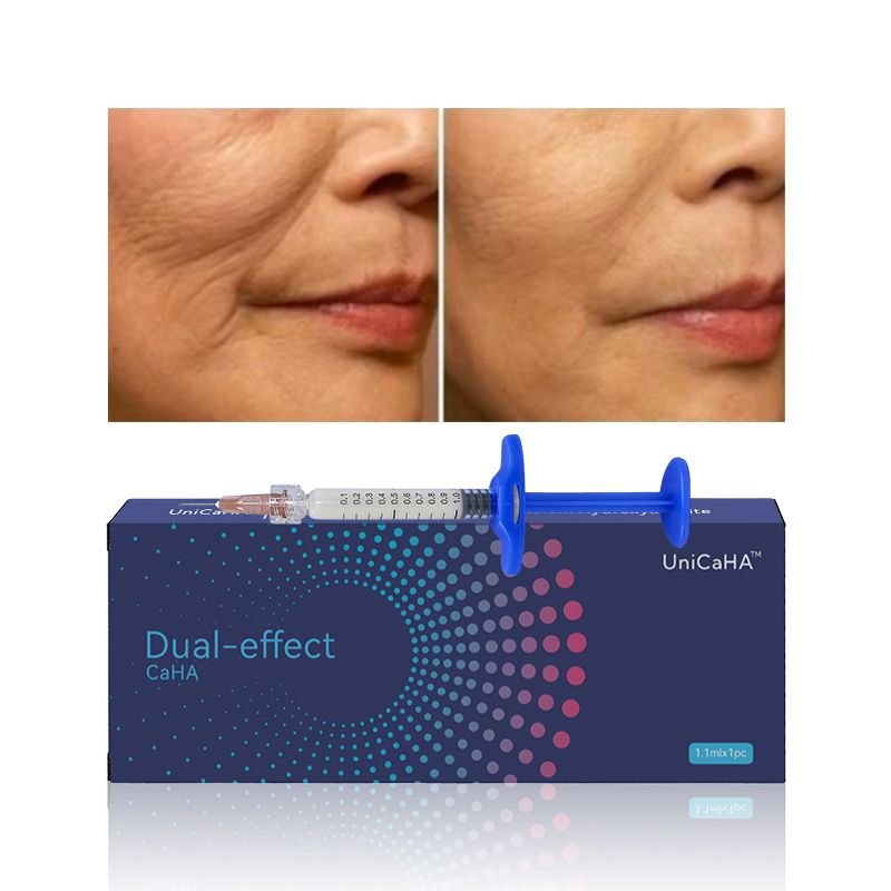 1.1ml syringe anti wrinkle caha hyaluronic acid calcium hydroxyapatite filler