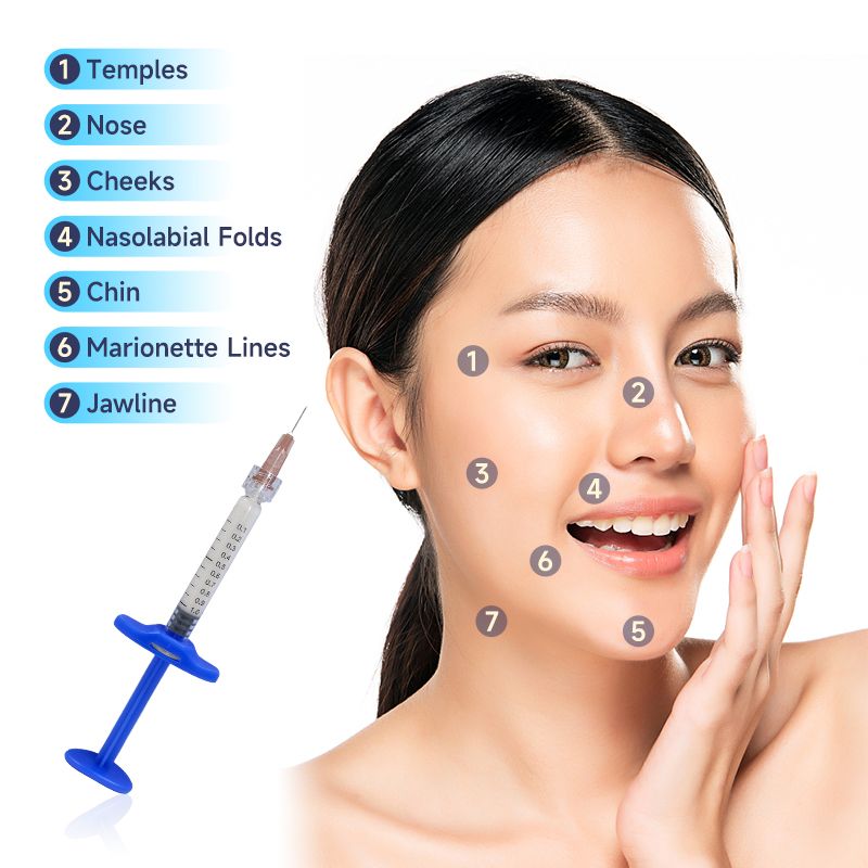 1.1ml syringe anti wrinkle caha hyaluronic acid calcium hydroxyapatite filler