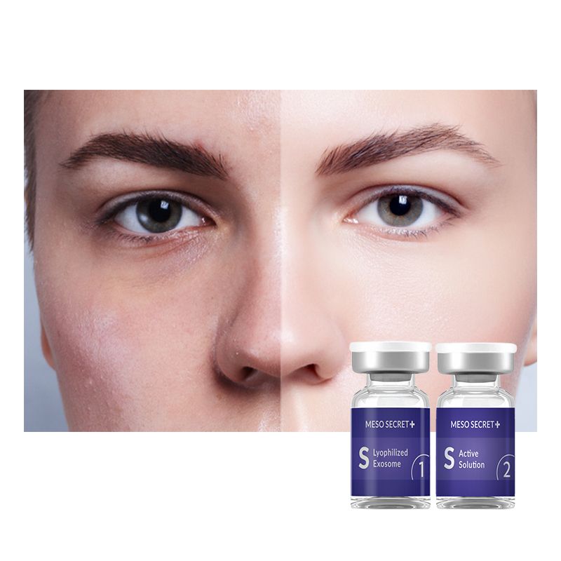New Product Anti-aging wrinkle reduction exosome lyophilized powder ampoule